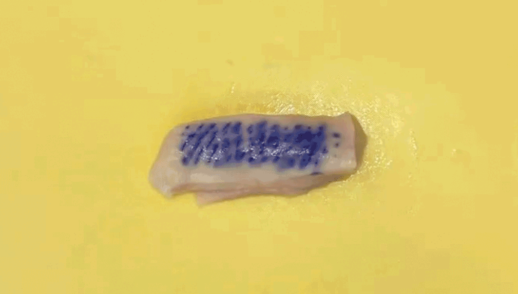 리즈온 무통 시스템 GIF